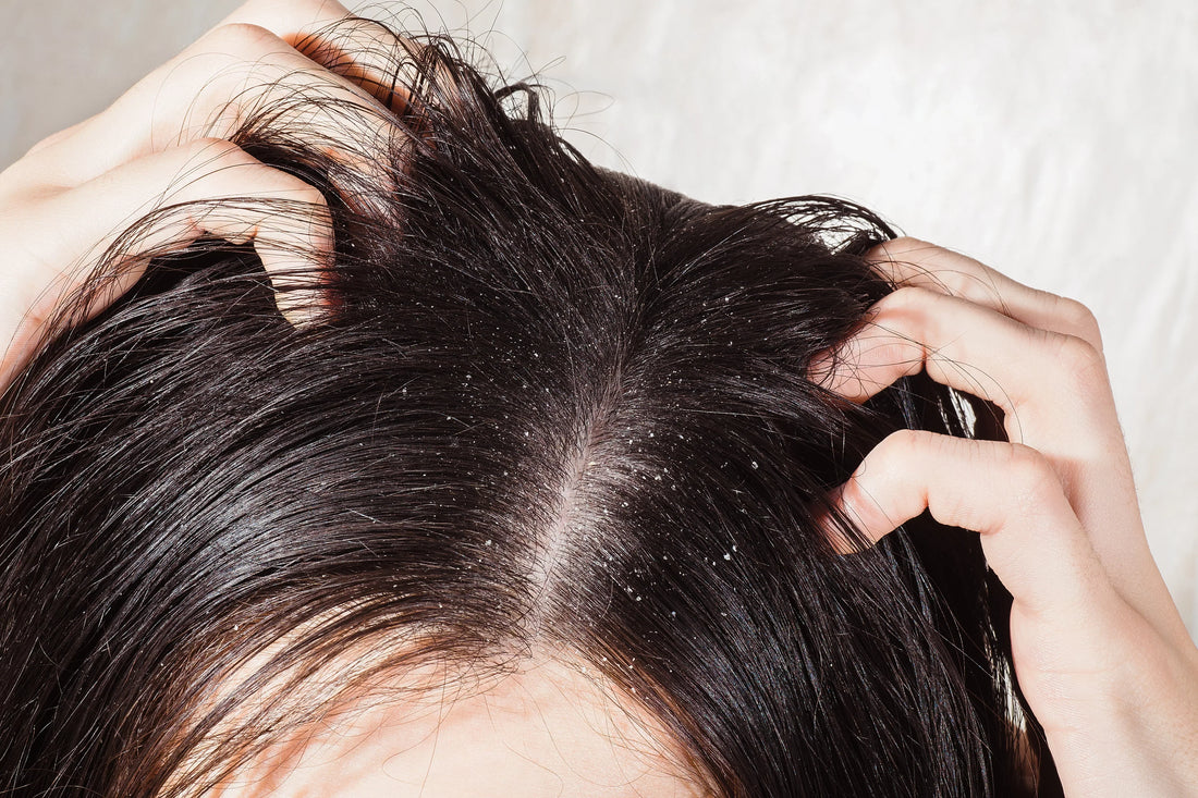 Oil Scalp But Dry Ends