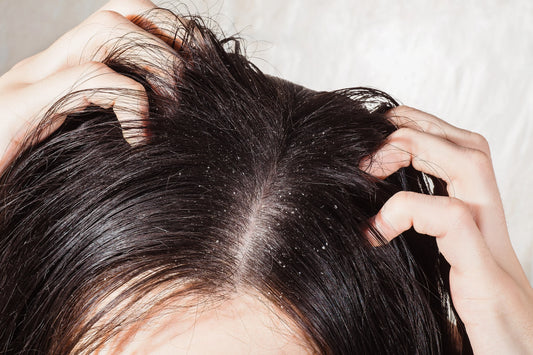 Oil Scalp But Dry Ends